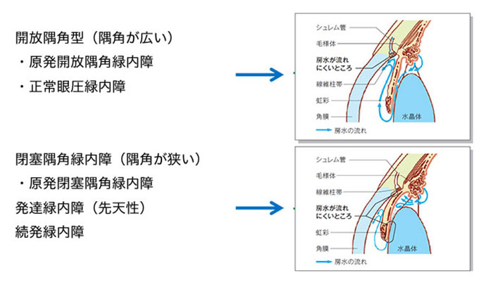 診療内容｜札幌 中央区 桑園 おくしば眼科